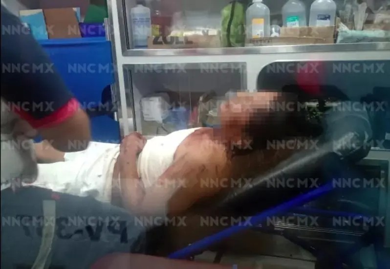 Puerto Vallarta. Intentaron matarlo a navajazos en la Emiliano Zapata
