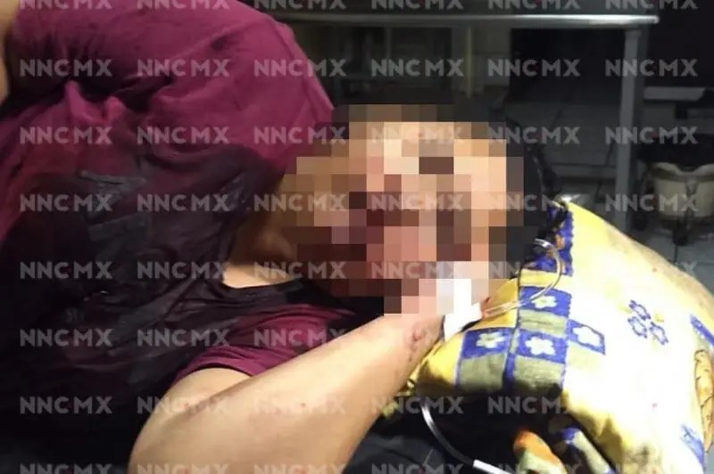 Alias “La Changa” baleó a su pareja