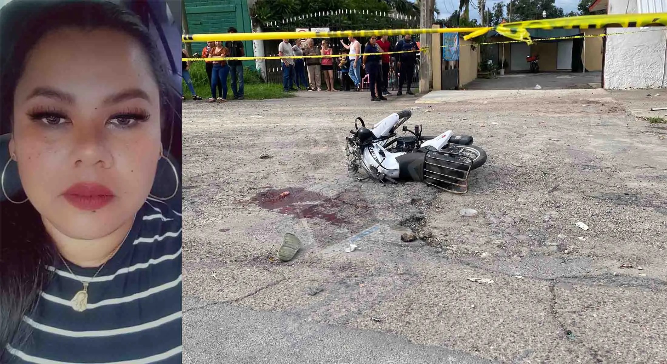 Declaran con muerte cerebral a mujer arrollada por razer en el Ahuacate