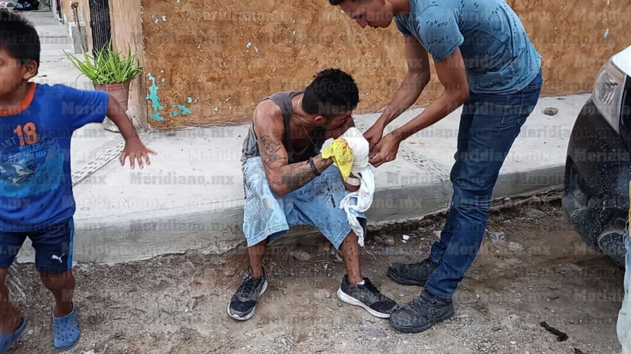 ¡Le volaron la mano a \"El Macaco\" en Mojoneras!