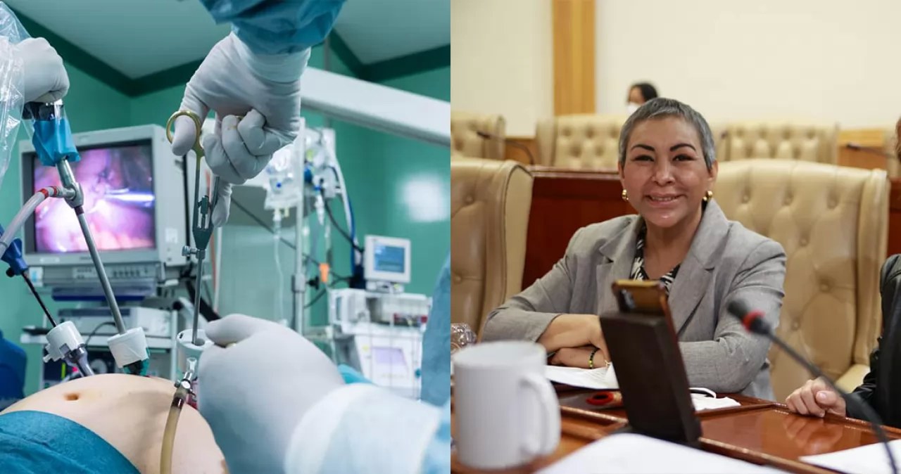 Nayarit en proceso de cirugías bariatricas