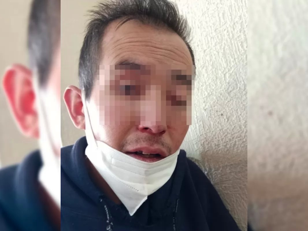 Pierde la vida paciente con posible hongo negro en México