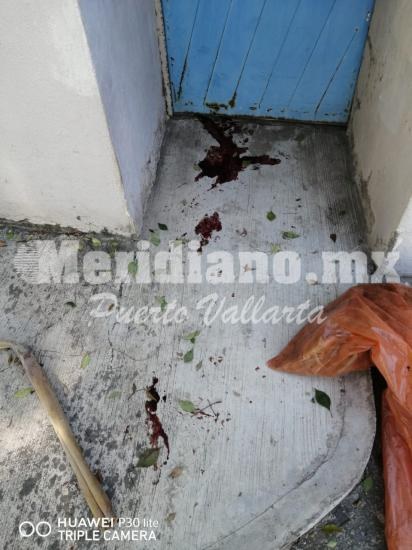 En la colonia independencia…  ¡un perro bravo atacó a ancianito!