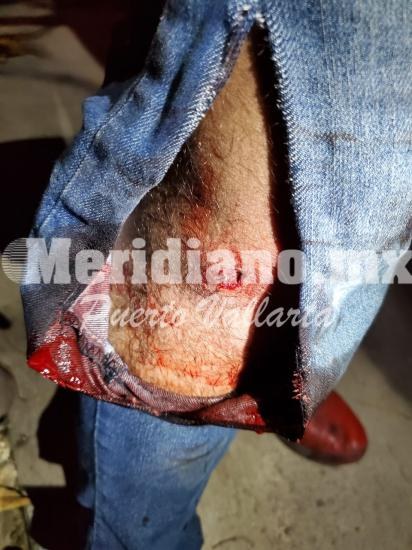 En colonia las canoas… ¡chocaron motociclistas!